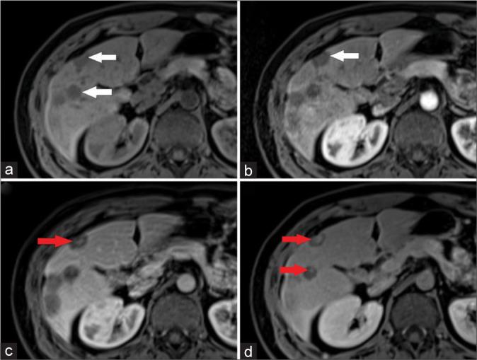https://cdn.ncbi.nlm.nih.gov/pmc/blobs/3fe2/11380813/740a2553b511/JCIS-14-32-g002.jpg