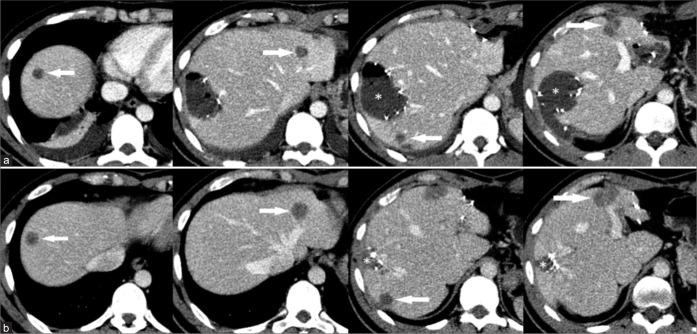 https://cdn.ncbi.nlm.nih.gov/pmc/blobs/3fe2/11380813/8ab0a34f48bb/JCIS-14-32-g008.jpg