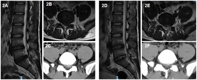 https://cdn.ncbi.nlm.nih.gov/pmc/blobs/3fe5/12213425/45f273269cfa/fneur-16-1551742-g002.jpg