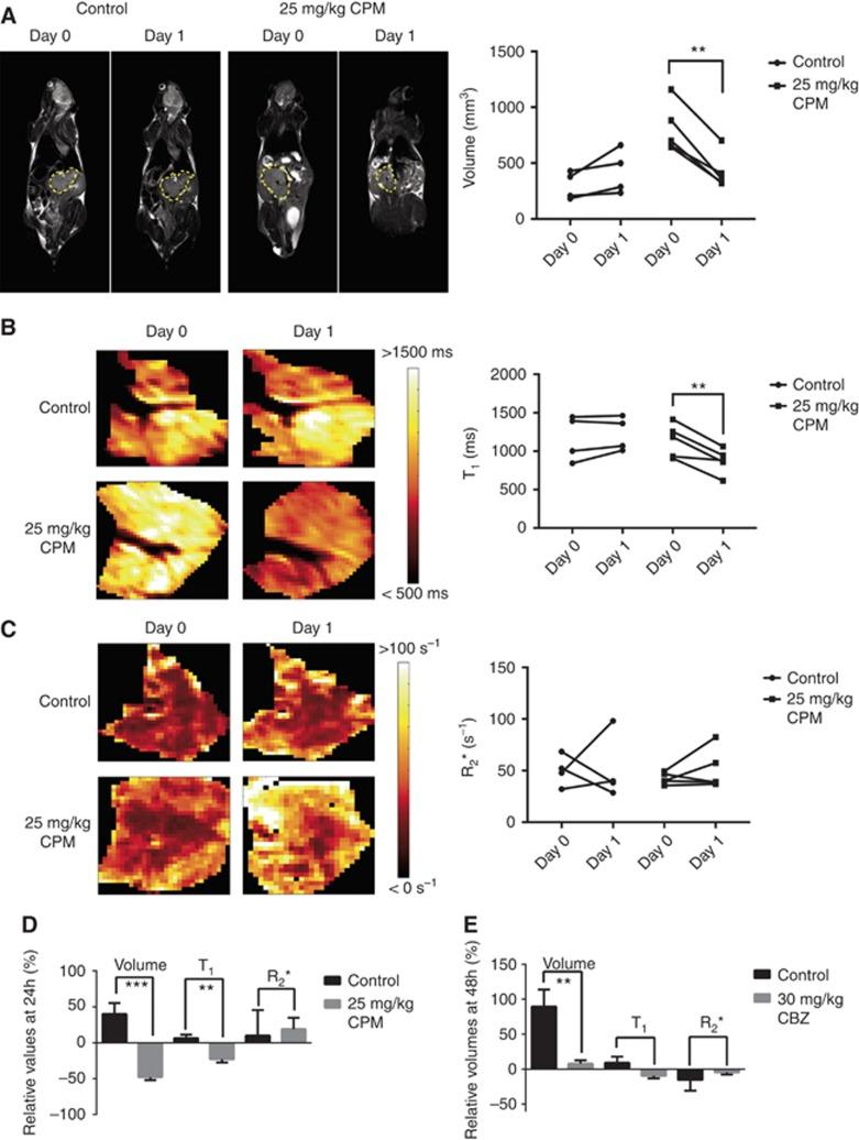 https://cdn.ncbi.nlm.nih.gov/pmc/blobs/3fe7/5589996/f4a24e47a594/bjc2017251f5.jpg