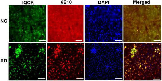 https://cdn.ncbi.nlm.nih.gov/pmc/blobs/3fe9/9344928/c8f84b7e2ae6/fncel-16-954071-g007.jpg