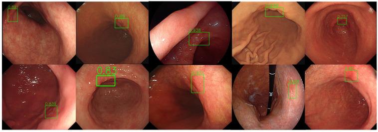 https://cdn.ncbi.nlm.nih.gov/pmc/blobs/3ff2/11639788/570eb6aeb25d/diagnostics-14-02706-g004.jpg
