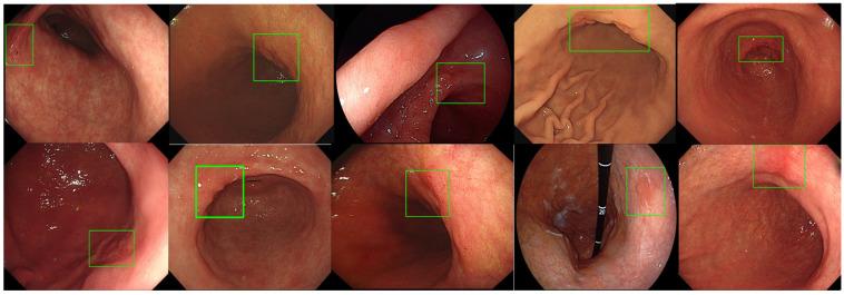 https://cdn.ncbi.nlm.nih.gov/pmc/blobs/3ff2/11639788/c9bdd36c5b0a/diagnostics-14-02706-g006.jpg