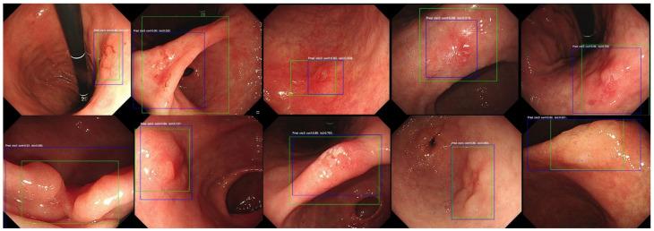 https://cdn.ncbi.nlm.nih.gov/pmc/blobs/3ff2/11639788/ca39a3d54917/diagnostics-14-02706-g003.jpg