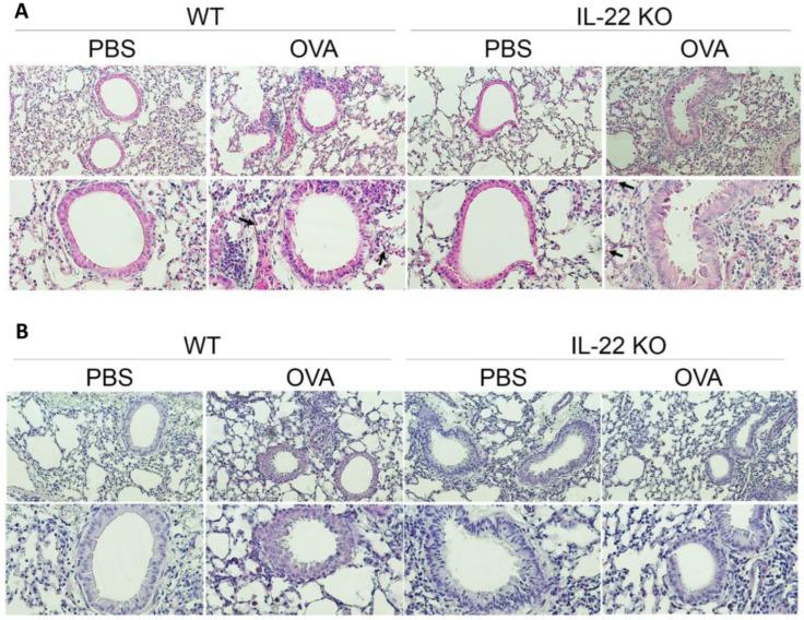https://cdn.ncbi.nlm.nih.gov/pmc/blobs/4010/10341917/d7abb9cdeb9d/ijms-24-10418-g002.jpg