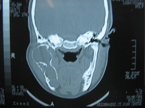 https://cdn.ncbi.nlm.nih.gov/pmc/blobs/4012/2821325/f1fc7760cfbf/1758-3284-2-1-3.jpg
