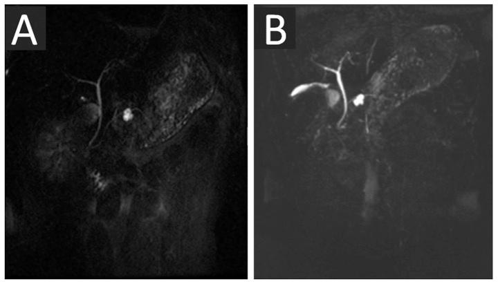 https://cdn.ncbi.nlm.nih.gov/pmc/blobs/401e/4356376/9b9ea3c49566/OL-09-04-1917-g03.jpg