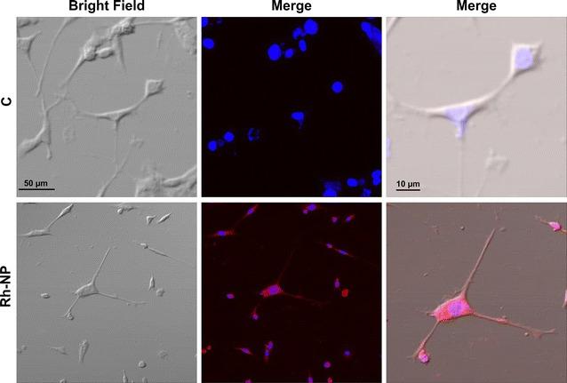 https://cdn.ncbi.nlm.nih.gov/pmc/blobs/4027/5297201/08abecf032fa/12951_2016_227_Fig2_HTML.jpg