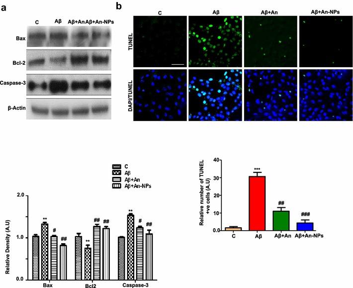 https://cdn.ncbi.nlm.nih.gov/pmc/blobs/4027/5297201/1c75e082a4a1/12951_2016_227_Fig5_HTML.jpg