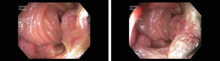https://cdn.ncbi.nlm.nih.gov/pmc/blobs/4027/8842692/054395c62d26/CNR2-5-e1455-g002.jpg