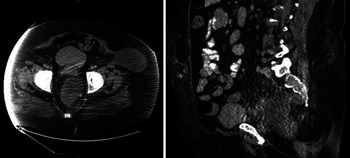 https://cdn.ncbi.nlm.nih.gov/pmc/blobs/4027/8842692/4ddae9eb4ba5/CNR2-5-e1455-g001.jpg