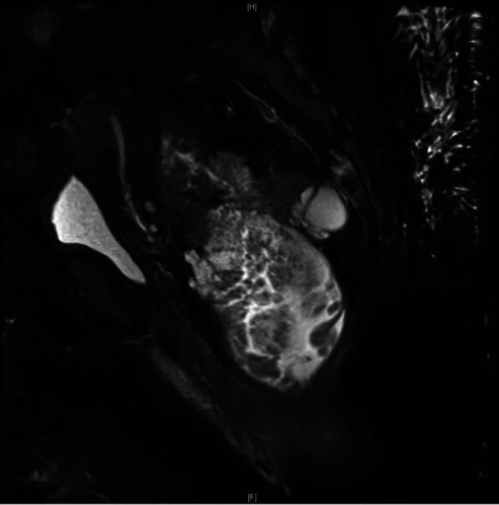 https://cdn.ncbi.nlm.nih.gov/pmc/blobs/4027/8842692/6a04ff23073c/CNR2-5-e1455-g006.jpg