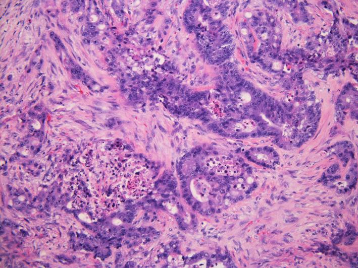 https://cdn.ncbi.nlm.nih.gov/pmc/blobs/4027/8842692/7e5b21f9425e/CNR2-5-e1455-g003.jpg
