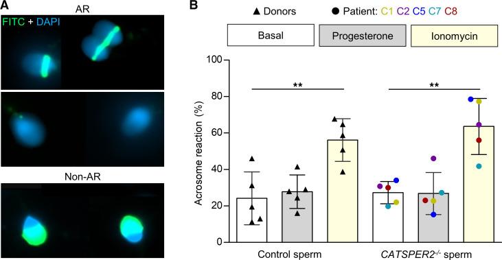 https://cdn.ncbi.nlm.nih.gov/pmc/blobs/402c/10760960/af80249a62a2/jci-134-173564-g095.jpg