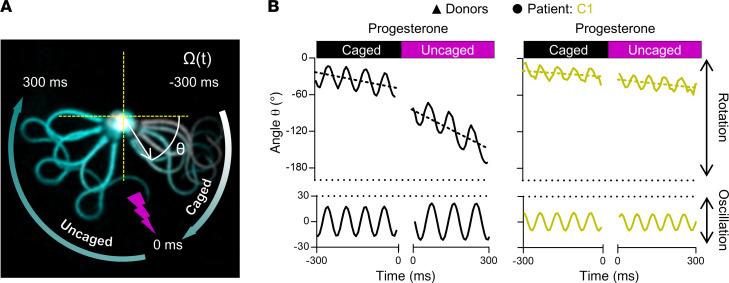 https://cdn.ncbi.nlm.nih.gov/pmc/blobs/402c/10760960/b50c4f433564/jci-134-173564-g101.jpg