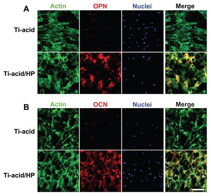 https://cdn.ncbi.nlm.nih.gov/pmc/blobs/402d/3548415/b09430fa206b/ijn-8-257f8.jpg