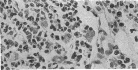 https://cdn.ncbi.nlm.nih.gov/pmc/blobs/4030/2028052/3df4f0df1309/brmedj03083-0021-d.jpg
