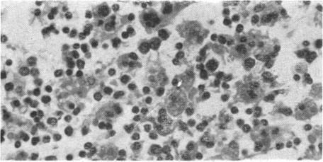 https://cdn.ncbi.nlm.nih.gov/pmc/blobs/4030/2028052/e4edc552601b/brmedj03083-0021-e.jpg