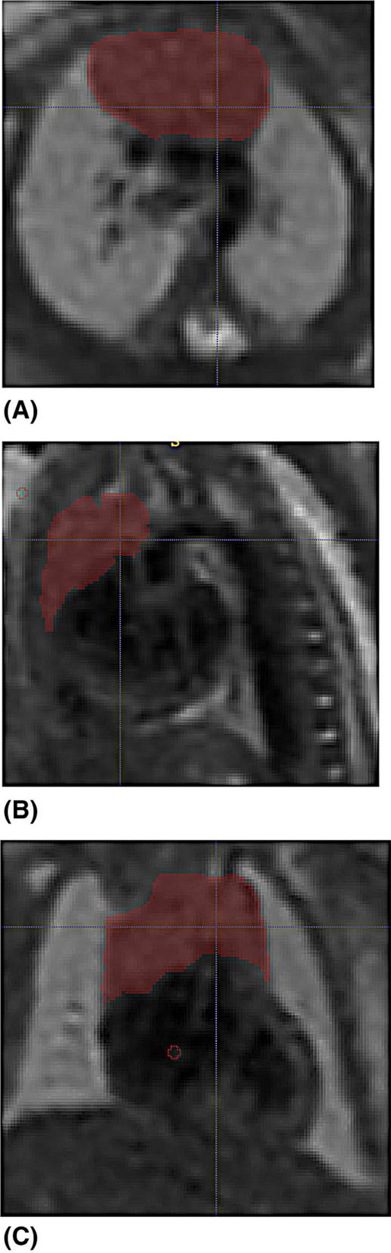 https://cdn.ncbi.nlm.nih.gov/pmc/blobs/4030/7614117/583fa15b2fc5/EMS157883-f001.jpg