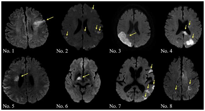 https://cdn.ncbi.nlm.nih.gov/pmc/blobs/4030/9353866/f60e0bac749c/ol-24-03-13437-g00.jpg