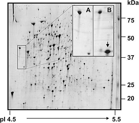 https://cdn.ncbi.nlm.nih.gov/pmc/blobs/4035/3818862/319d9403e27a/mbt0004-0216-f2.jpg