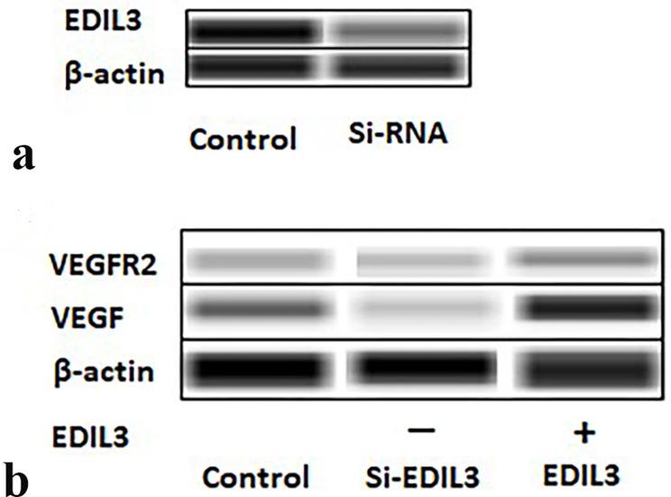 https://cdn.ncbi.nlm.nih.gov/pmc/blobs/4036/10202143/04161e245aa3/CCID-16-1269-g0002.jpg