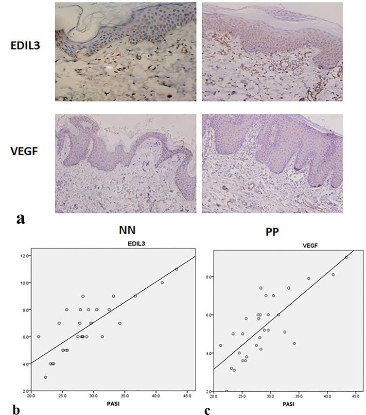 https://cdn.ncbi.nlm.nih.gov/pmc/blobs/4036/10202143/95f4cf34ca5e/CCID-16-1269-g0001.jpg