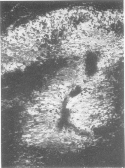 https://cdn.ncbi.nlm.nih.gov/pmc/blobs/4036/503235/02b86e176874/jnnpsyc00295-0012-a.jpg