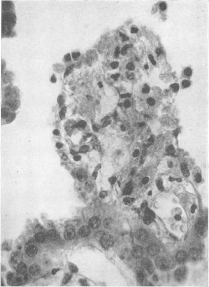 https://cdn.ncbi.nlm.nih.gov/pmc/blobs/4036/503235/393c7132ab01/jnnpsyc00295-0013-a.jpg