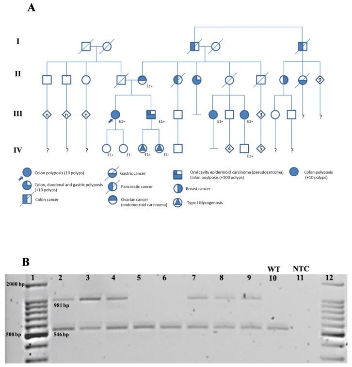 https://cdn.ncbi.nlm.nih.gov/pmc/blobs/4038/7997431/d9bd69891609/diagnostics-11-00411-g002.jpg