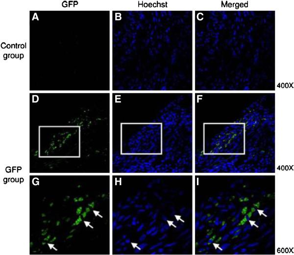 https://cdn.ncbi.nlm.nih.gov/pmc/blobs/403a/3653772/60927c0c3634/1476-7120-11-11-7.jpg
