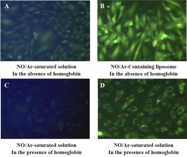 https://cdn.ncbi.nlm.nih.gov/pmc/blobs/403a/3653772/a71a2660c51c/1476-7120-11-11-5.jpg