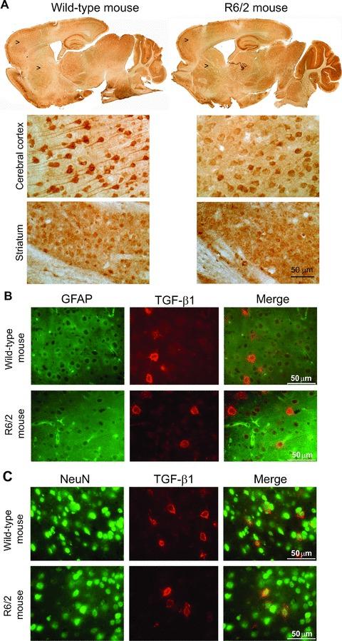 https://cdn.ncbi.nlm.nih.gov/pmc/blobs/403c/3922377/3add7a2b6a63/jcmm0015-0555-f6.jpg
