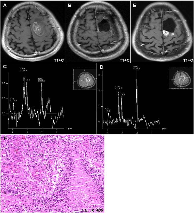 https://cdn.ncbi.nlm.nih.gov/pmc/blobs/403c/7747764/04a2dc11b549/fneur-11-592155-g0001.jpg