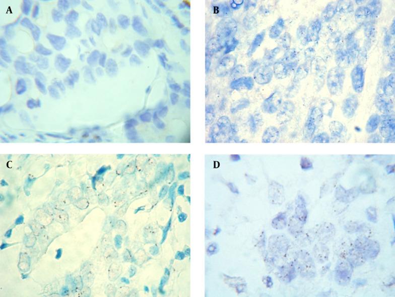 https://cdn.ncbi.nlm.nih.gov/pmc/blobs/403e/4863201/ff0d42351f3a/ircmj-18-02-21221-g001.jpg