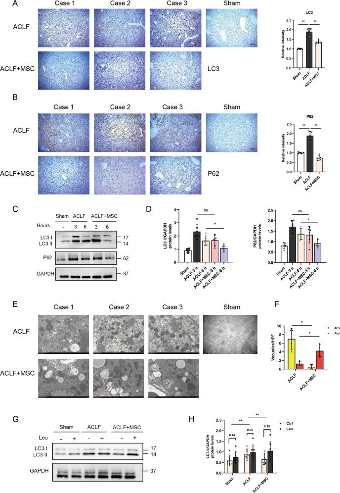 https://cdn.ncbi.nlm.nih.gov/pmc/blobs/403e/9556718/9d5b3558d647/41419_2022_5303_Fig2_HTML.jpg