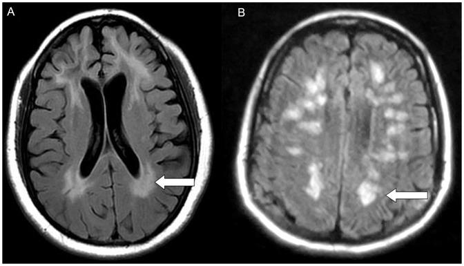 https://cdn.ncbi.nlm.nih.gov/pmc/blobs/403f/3568150/08630808553e/pone.0055758.g001.jpg