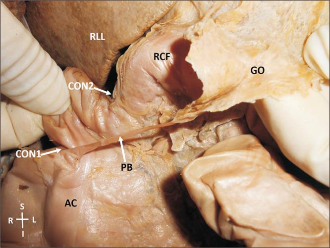https://cdn.ncbi.nlm.nih.gov/pmc/blobs/403f/7527129/85e3b8786e04/ACB-53-372-f2.jpg