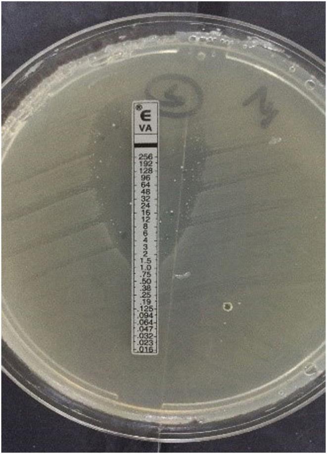 https://cdn.ncbi.nlm.nih.gov/pmc/blobs/404e/7506076/ed7e93ea4217/fmed-07-00403-g0002.jpg