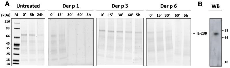 https://cdn.ncbi.nlm.nih.gov/pmc/blobs/4052/5535866/6e313e09b8b7/ijms-18-01373-g004.jpg