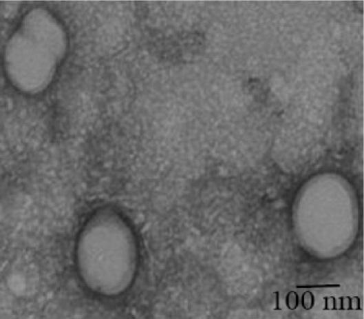 https://cdn.ncbi.nlm.nih.gov/pmc/blobs/405d/3209422/fcf681b041d6/mv-v17-2724-f4.jpg