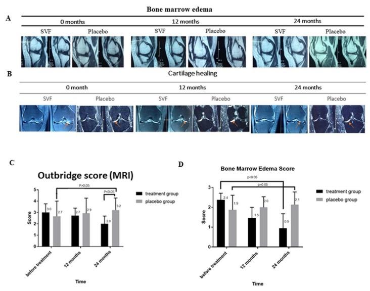 https://cdn.ncbi.nlm.nih.gov/pmc/blobs/4060/6523621/f6c82d94a43d/cells-08-00308-g003.jpg