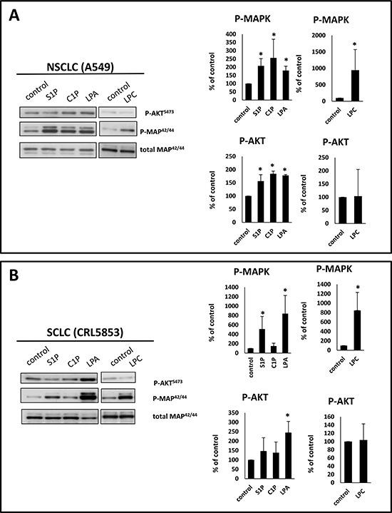https://cdn.ncbi.nlm.nih.gov/pmc/blobs/4061/5601648/6cf45c279de3/oncotarget-08-58247-g002.jpg