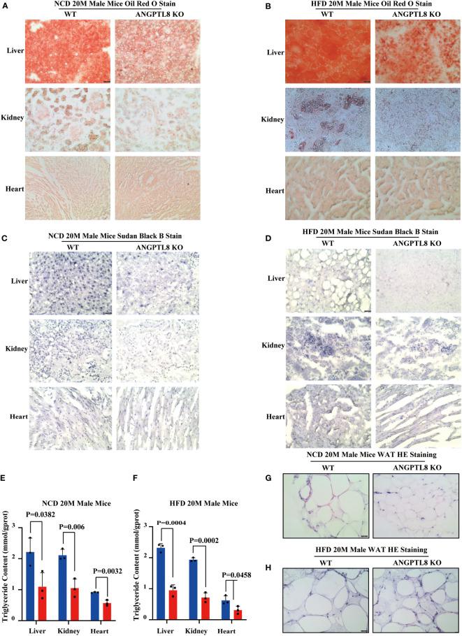 https://cdn.ncbi.nlm.nih.gov/pmc/blobs/4062/9404696/b949857dfcc3/fendo-13-927763-g003.jpg