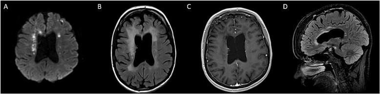 https://cdn.ncbi.nlm.nih.gov/pmc/blobs/4068/12118061/7fd26750f960/omaf038f2.jpg