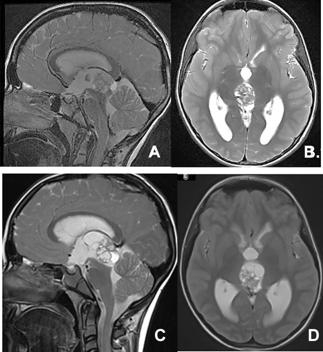 https://cdn.ncbi.nlm.nih.gov/pmc/blobs/406a/10432319/16cb8f21c2c5/381_2022_5595_Fig8_HTML.jpg