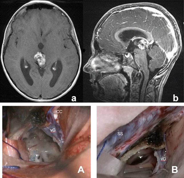 https://cdn.ncbi.nlm.nih.gov/pmc/blobs/406a/10432319/4986ad3619d1/381_2022_5595_Fig3_HTML.jpg