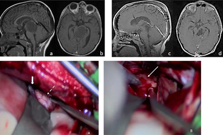 https://cdn.ncbi.nlm.nih.gov/pmc/blobs/406a/10432319/723774884fbc/381_2022_5595_Fig6_HTML.jpg