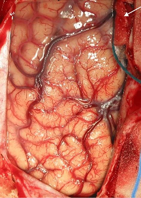 https://cdn.ncbi.nlm.nih.gov/pmc/blobs/406a/10432319/a06d57c1a27b/381_2022_5595_Fig1_HTML.jpg