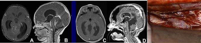 https://cdn.ncbi.nlm.nih.gov/pmc/blobs/406a/10432319/aa95e95f4cfa/381_2022_5595_Fig7_HTML.jpg